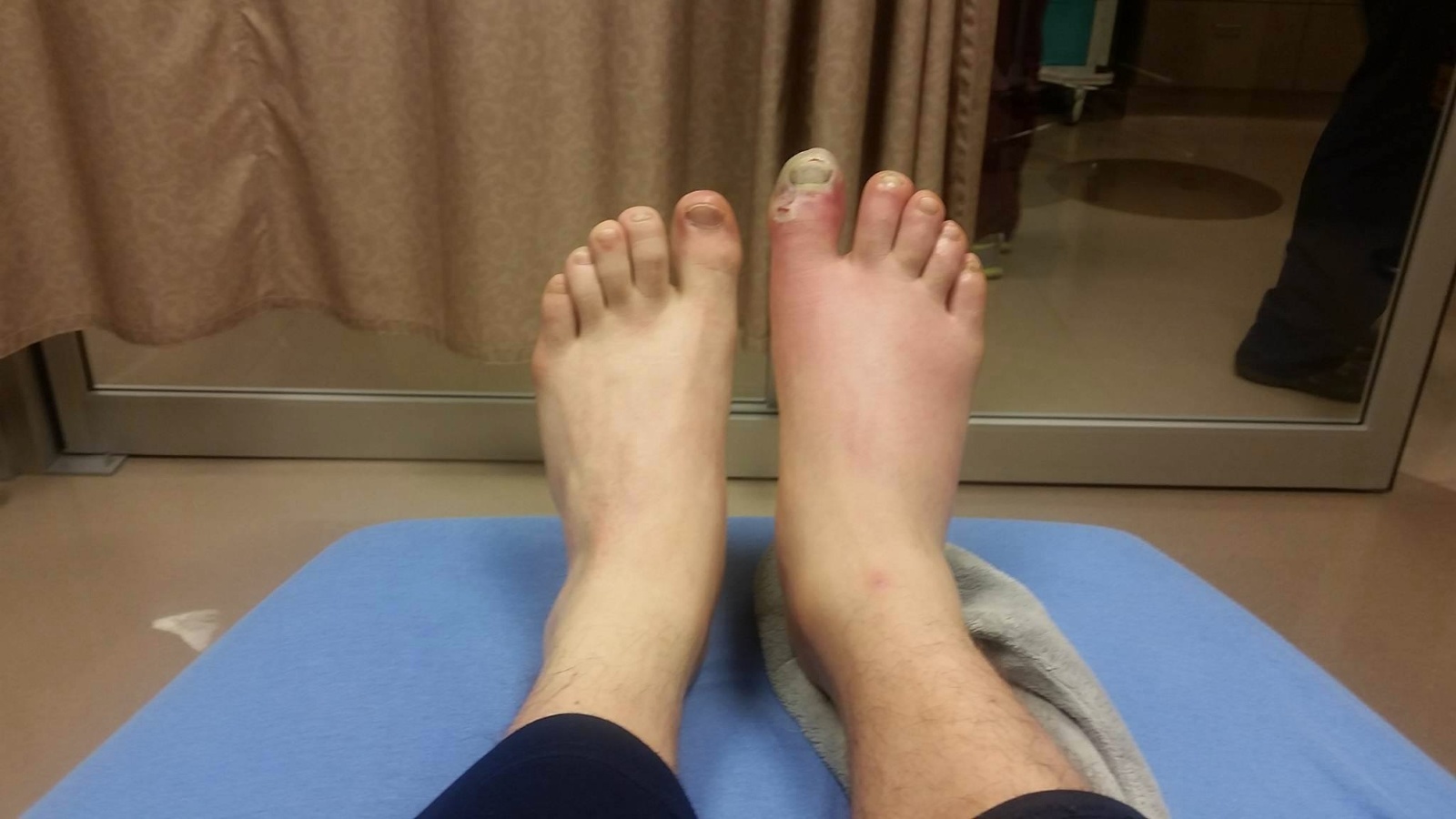 Inoue toe 1