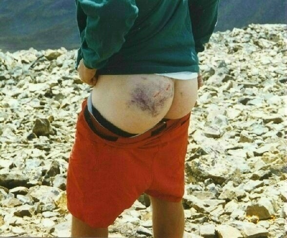 Butt