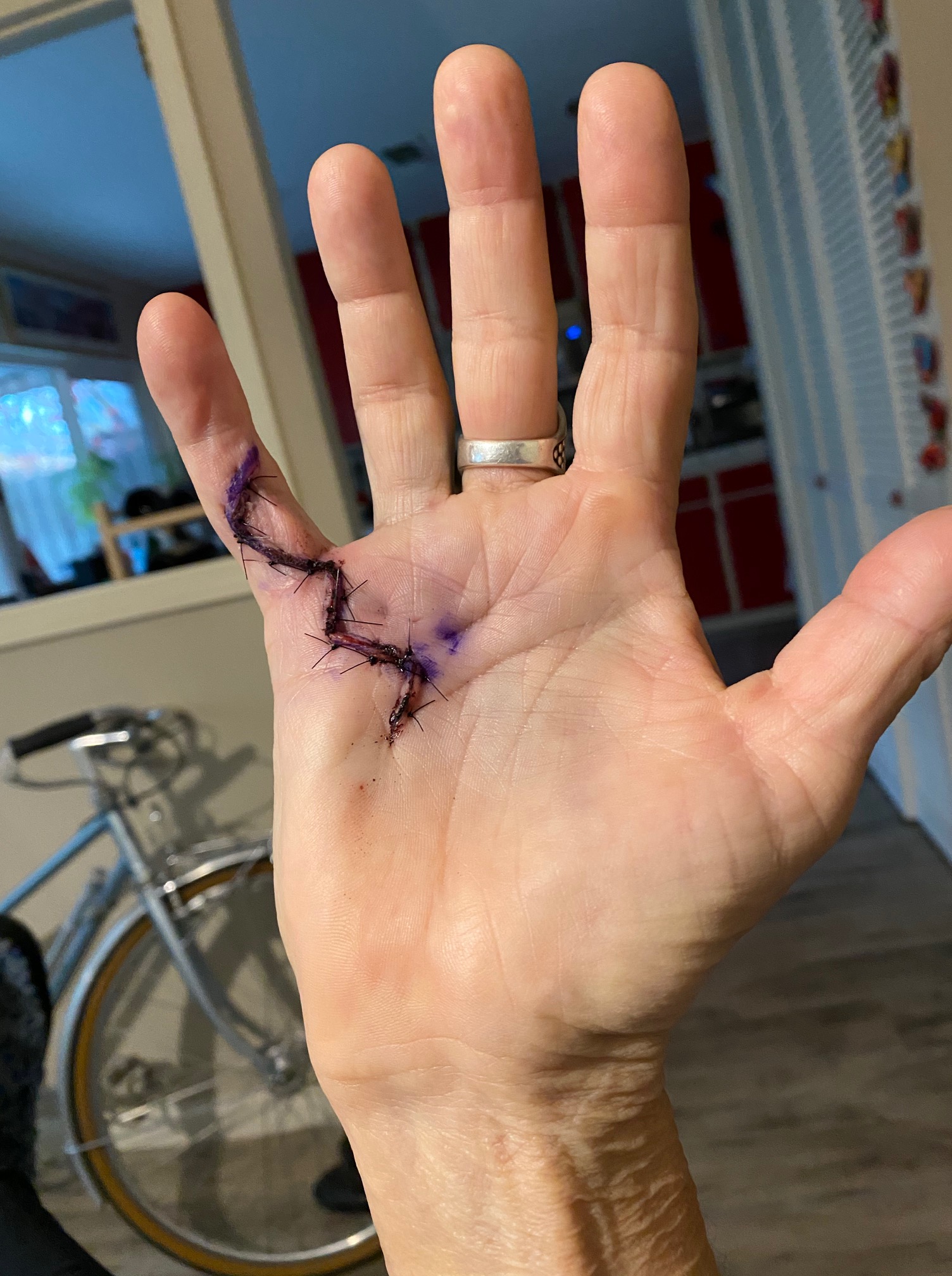 Mrsb hand