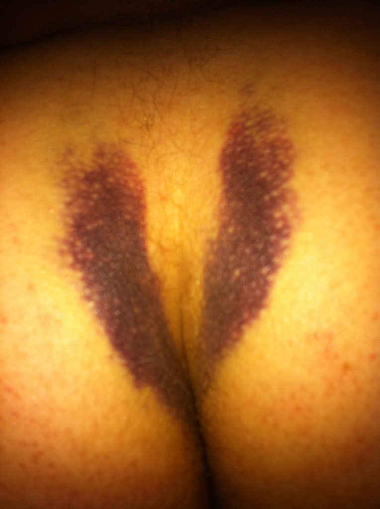 Mtb ass