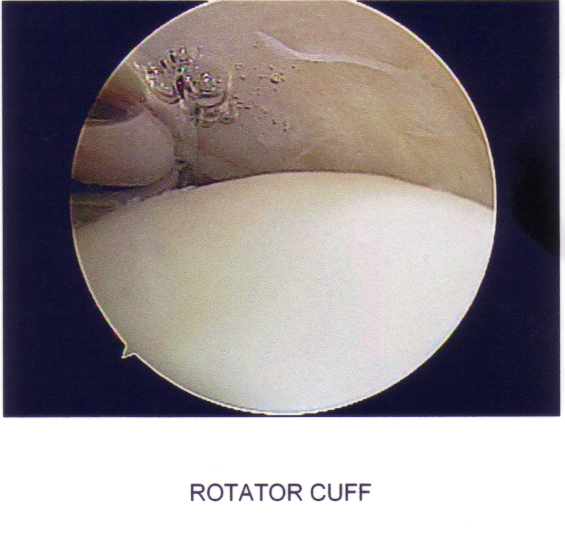 Shoulder12