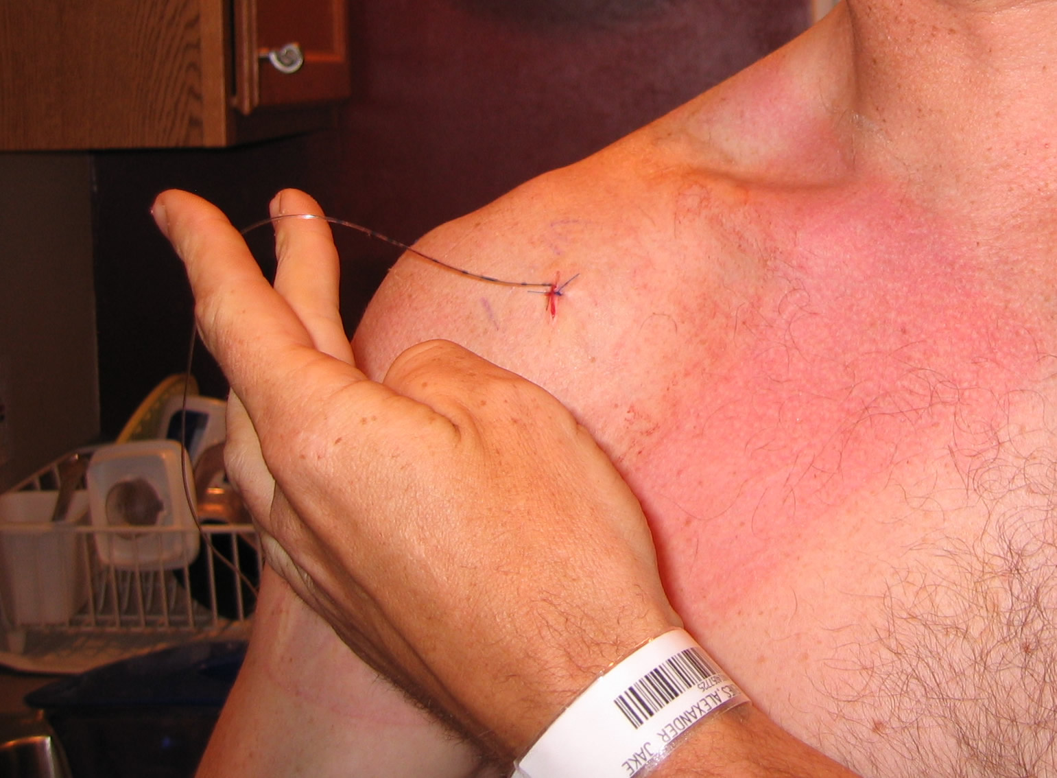 Shoulder28