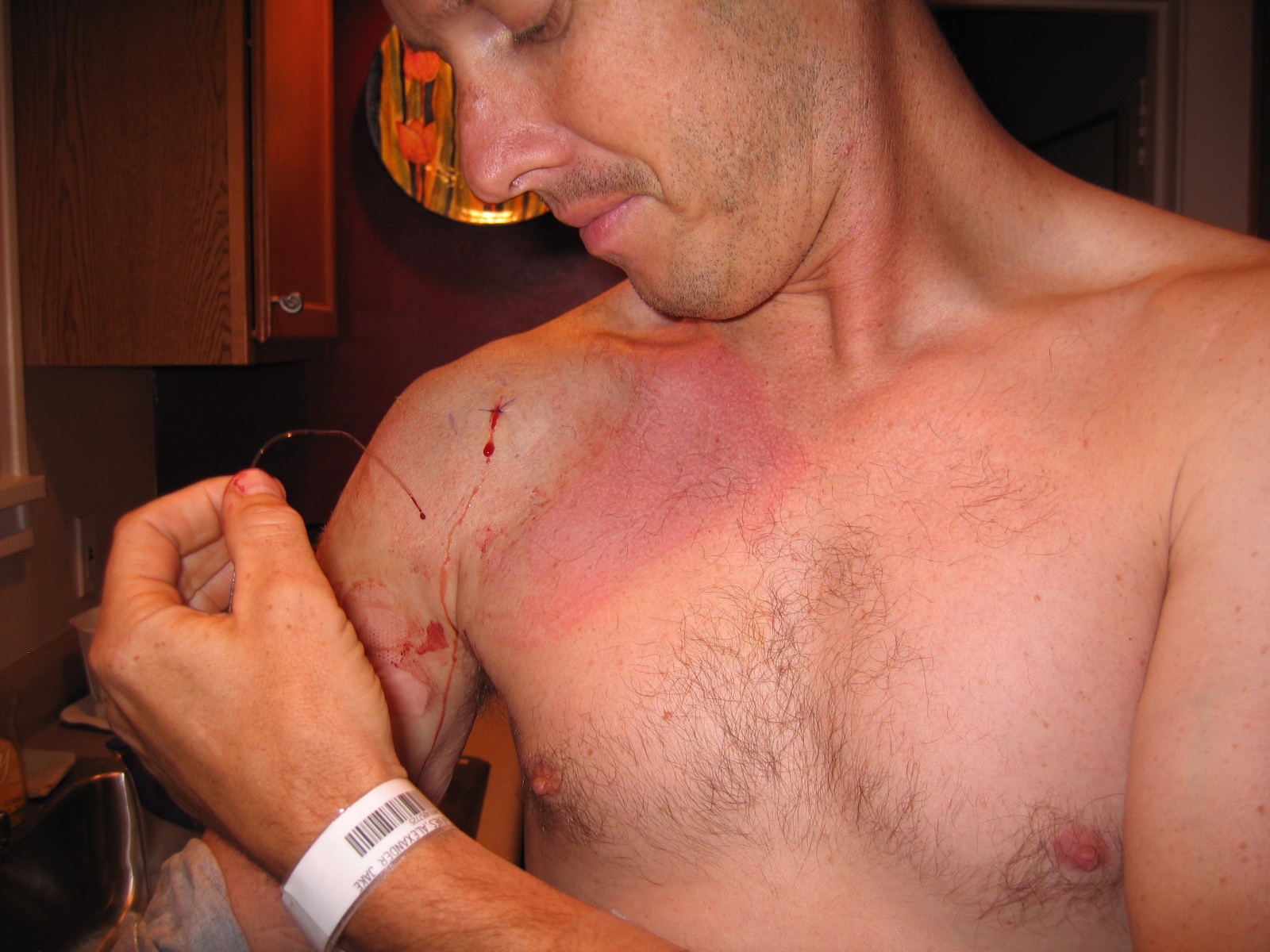 Shoulder29